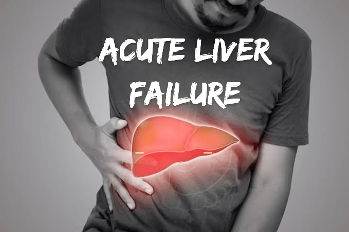 Acute liver failure কিন্তু Jaundice নেই !! এমনটা কি হতে পারে?
