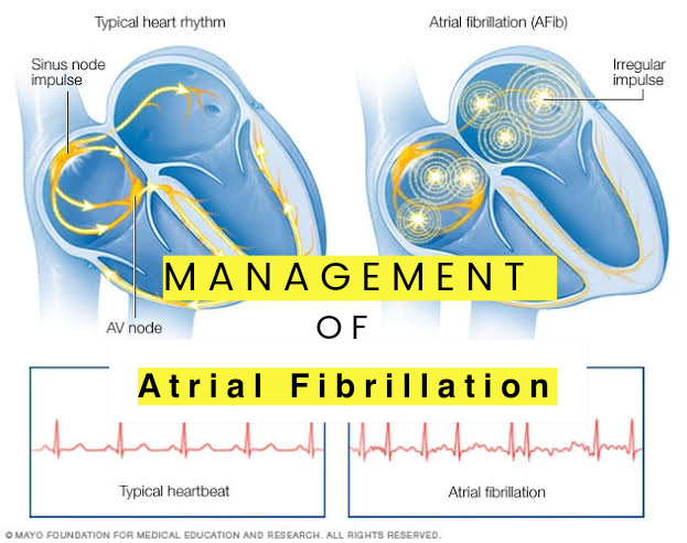 𝗔𝘁𝗿𝗶𝗮𝗹 𝗙𝗶𝗯𝗿𝗶𝗹𝗹𝗮𝘁𝗶𝗼𝗻 এর Management শিখুন।