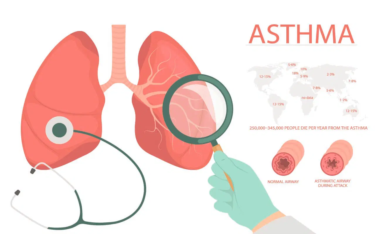 Asthma রোগীকে যে ওষুধগুলো দেওয়া যাবে না