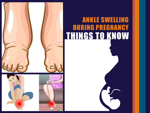 What Factors may affect Swelling of leg during Pregnancy?