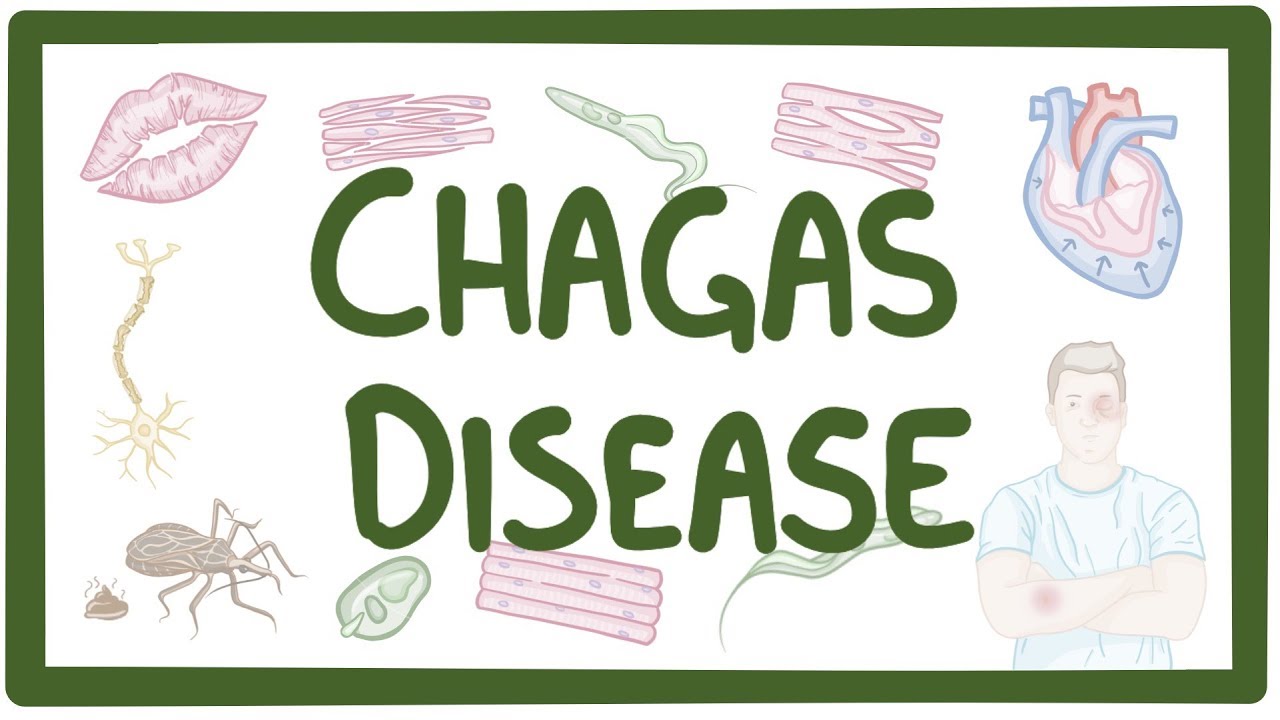 Chagas disease কী কারনে হয় ??
