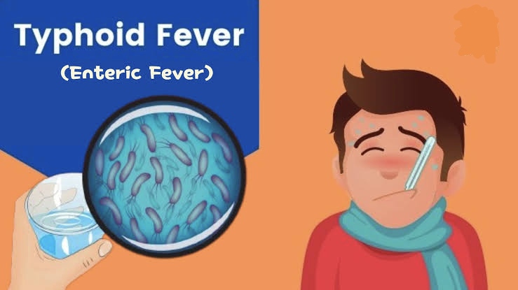 Typhoid Fever এর বিস্তারিত আলোচনা !!!