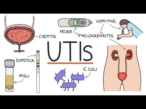 Treatment Of UTI !!