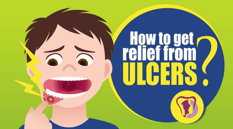 Learn About APTHOUS ULCER !!
