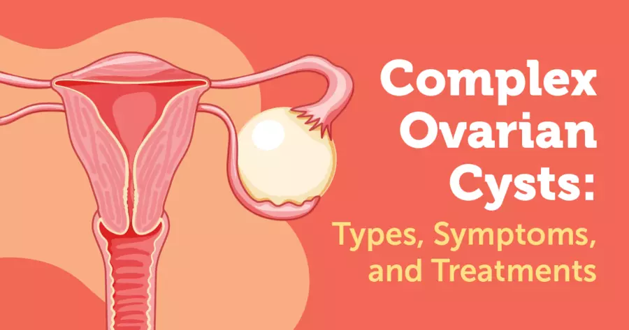 Know About Ovarian Cyst !!