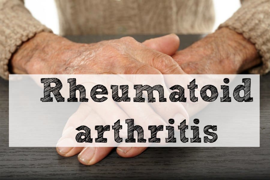 Investigations Of Rheumatoid arthritis !!