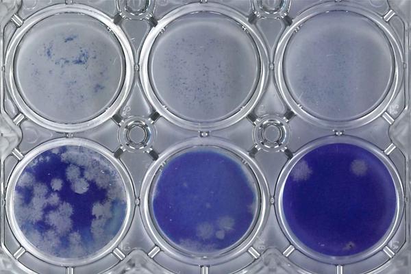 Viral Culture In COVID-19